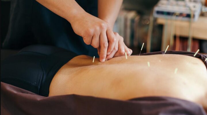 Acupuncture pour sportifs