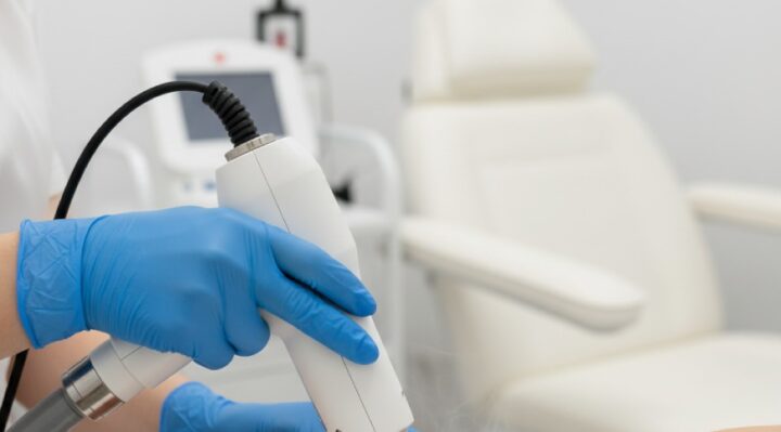 Traitement au laser par un professionnel